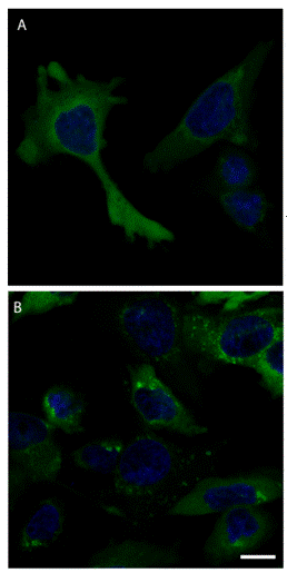 HeLa cells with treated with SirReal2